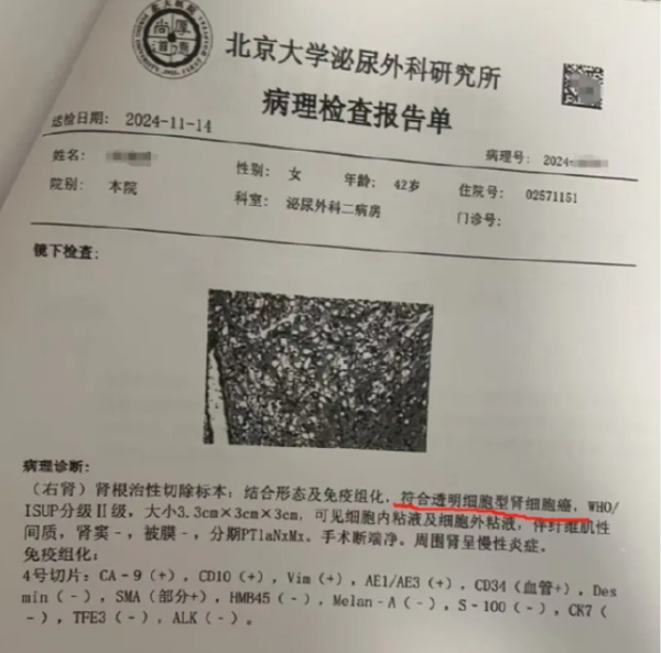 领航配资 爱康再回应“女子体检十年无异常却患癌”：病情发展速度极快